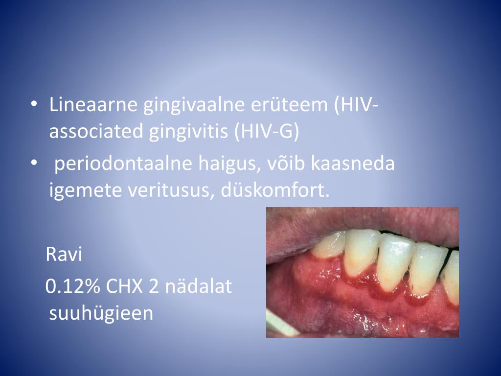 PPT HIV infektsiooniga kaasnevad limaskestade nähud PowerPoint