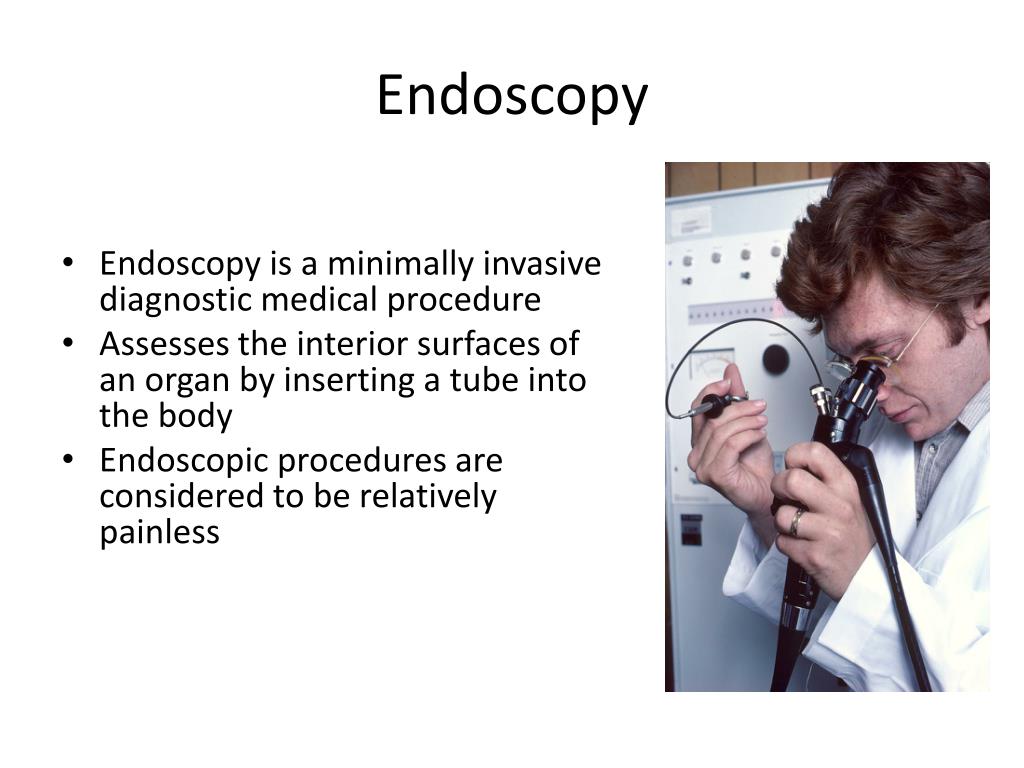 PPT Endoscopy PowerPoint Presentation, free download ID5410182