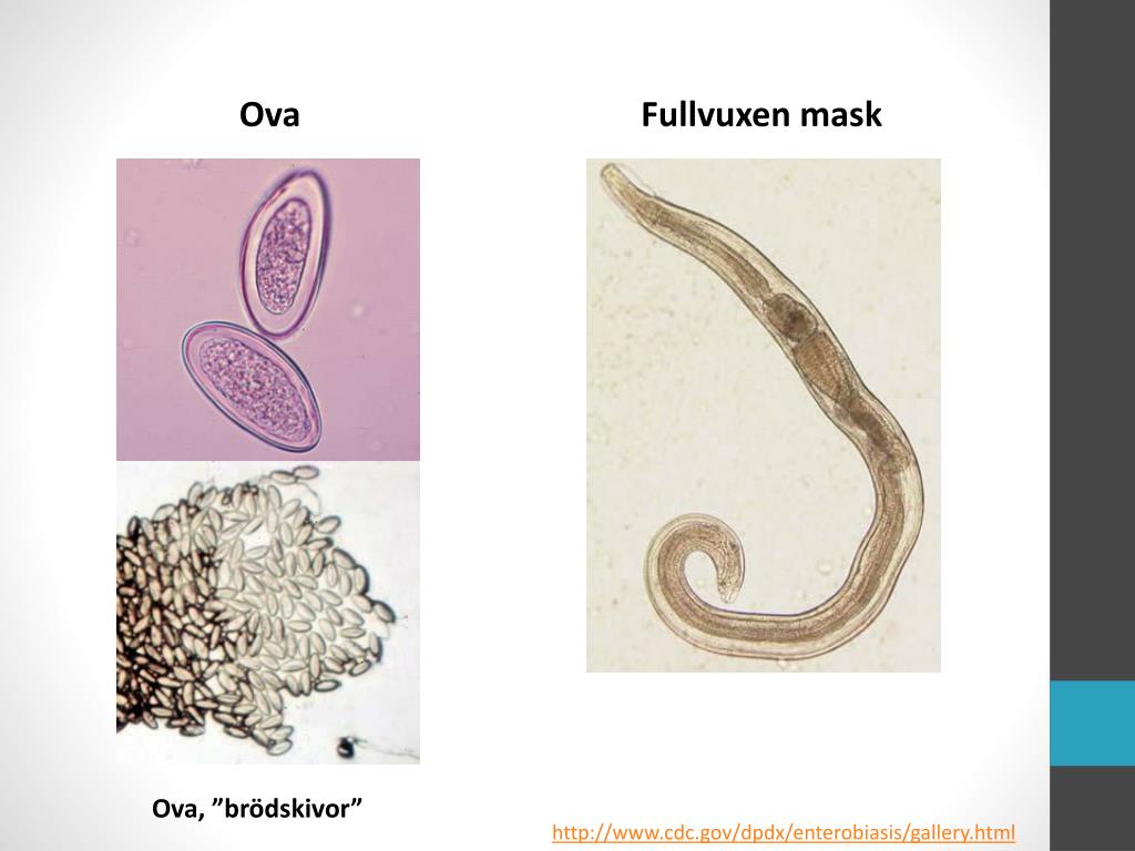 PPT Parasitologi Tarmparasiter Maskar PowerPoint Presentation, free