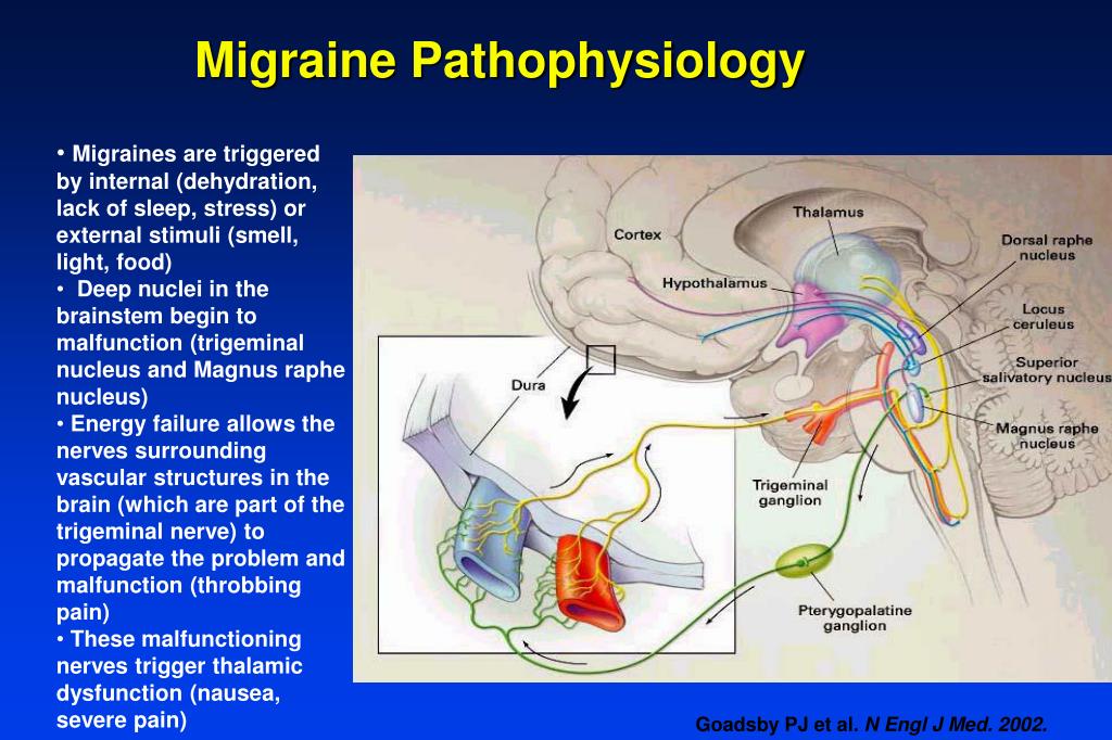 PPT Living with Headaches PowerPoint Presentation, free download ID