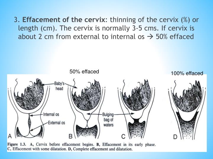 PPT Pelvic examination PowerPoint Presentation ID5450733