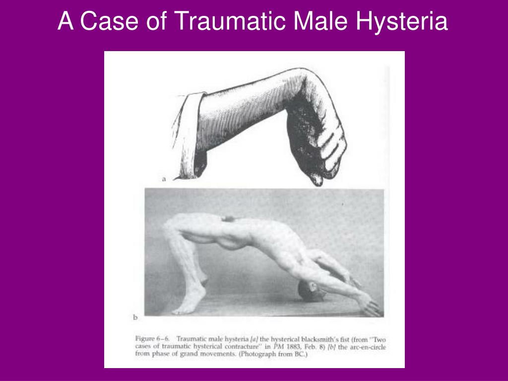 PPT The Hysterical Self Psychology in the Clinic PowerPoint