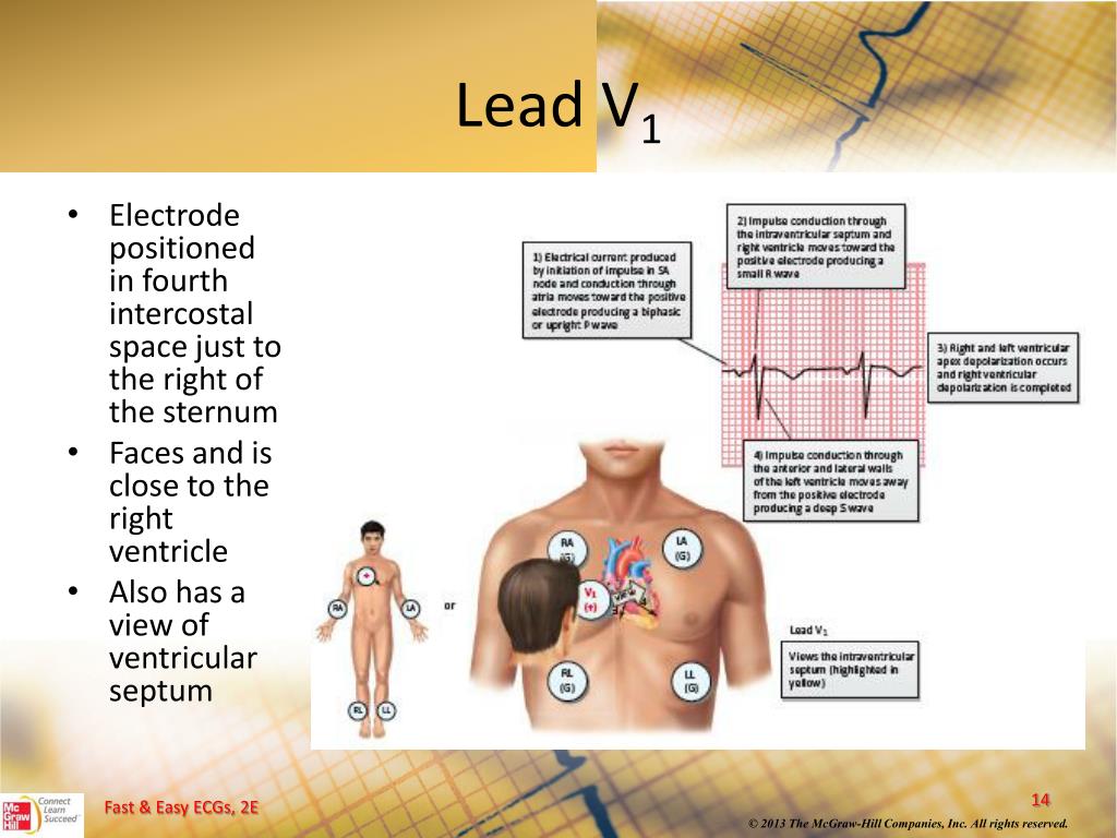 PPT 12Lead ECGs and Electrical Axis PowerPoint Presentation, free