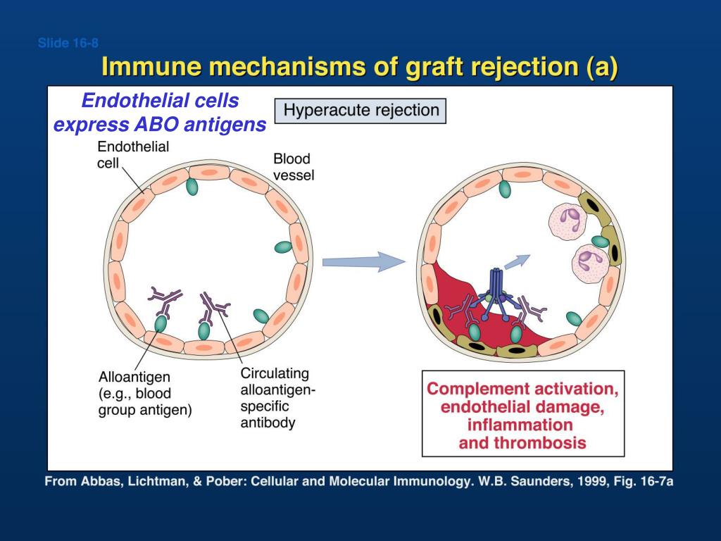 PPT Lecture 17 Transplantation PowerPoint Presentation, free