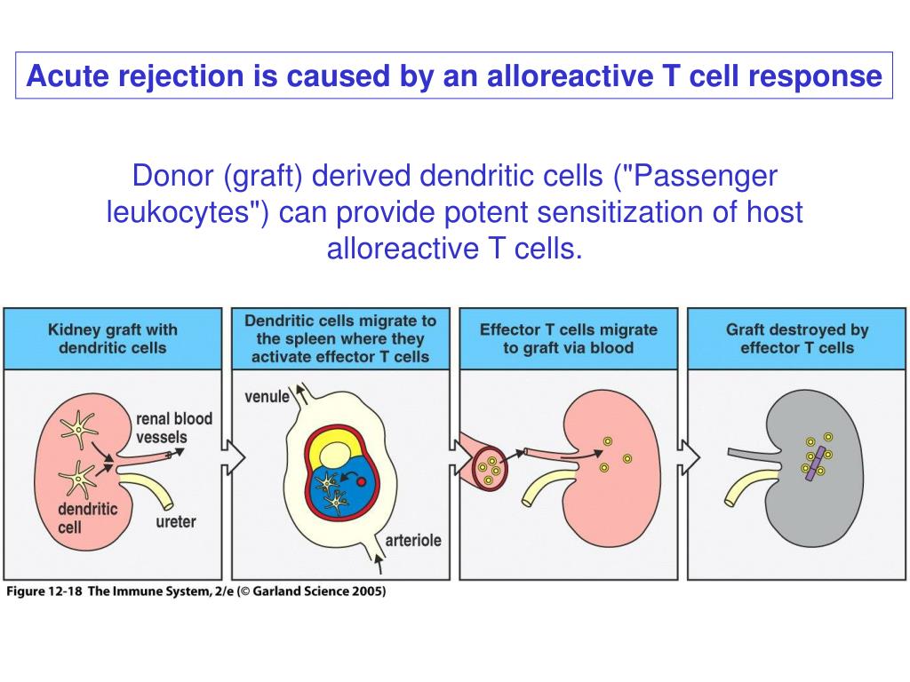 PPT Lecture 17 Transplantation PowerPoint Presentation, free