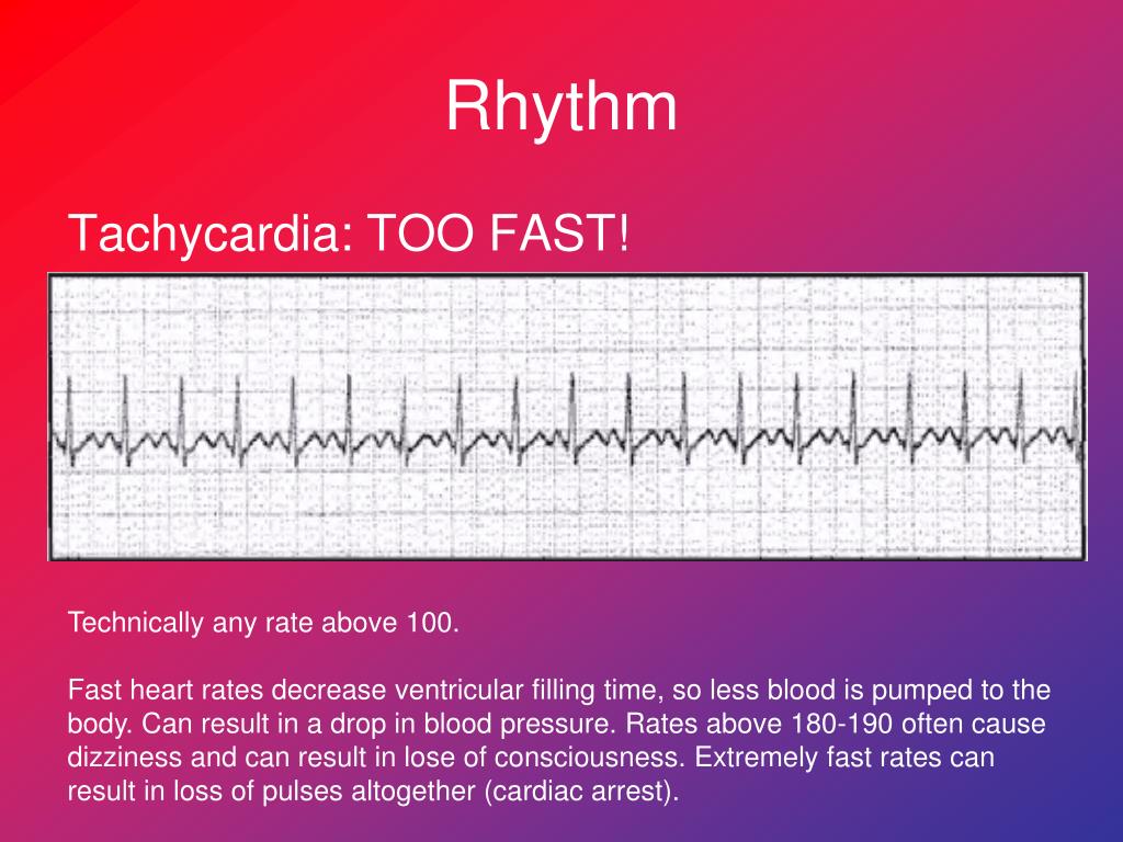 PPT Electrocardiogram (ECG) PowerPoint Presentation
