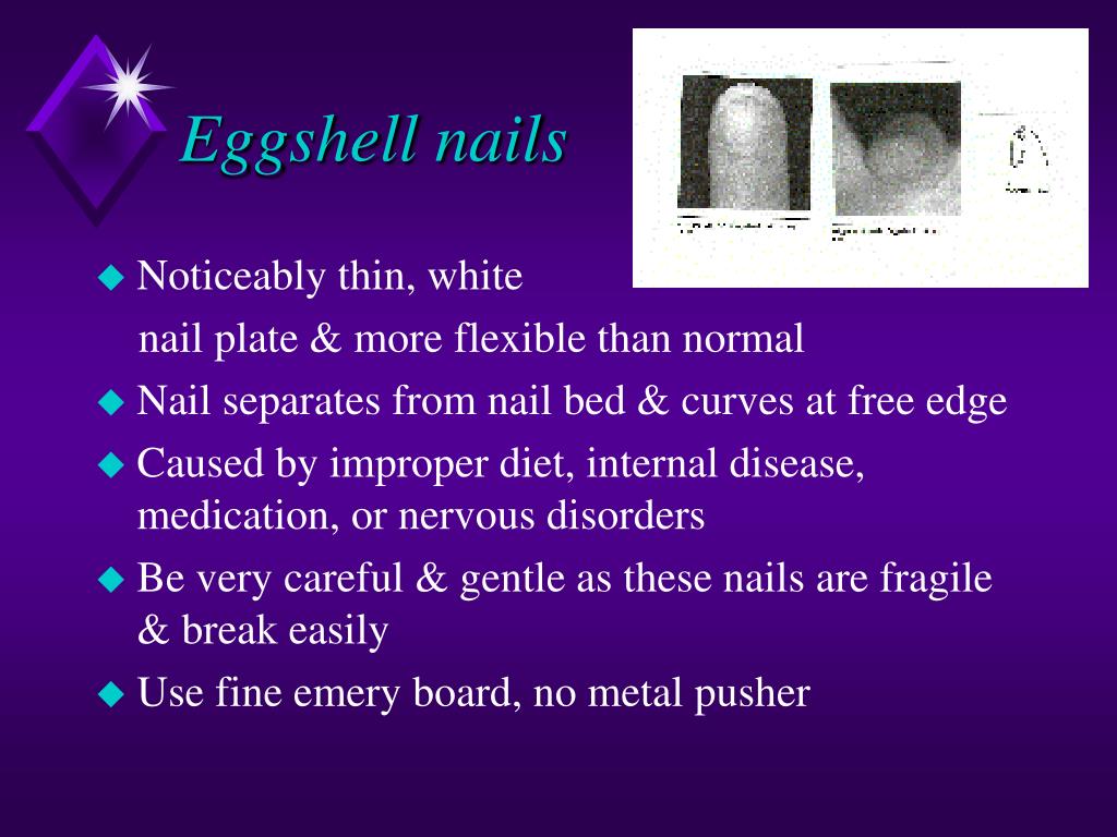 PPT Nail Diseases PowerPoint Presentation, free download ID5509362