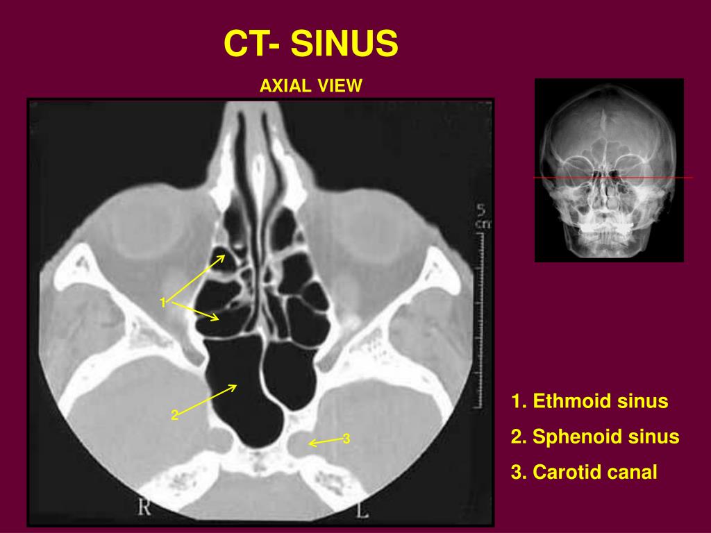 PPT M1 RADIOLOGY Head and Neck PowerPoint Presentation, free
