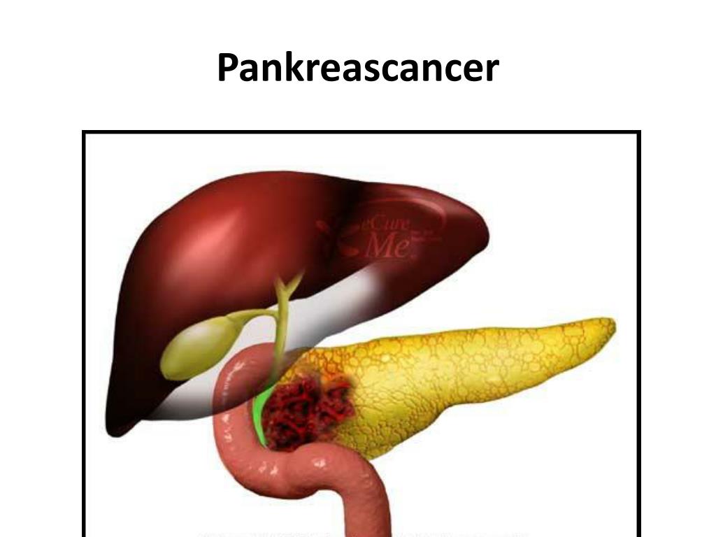 PPT FARMAKOLOGI, SJUKDOMSLÄRA OCH LÄKEMEDELSKEMI PowerPoint