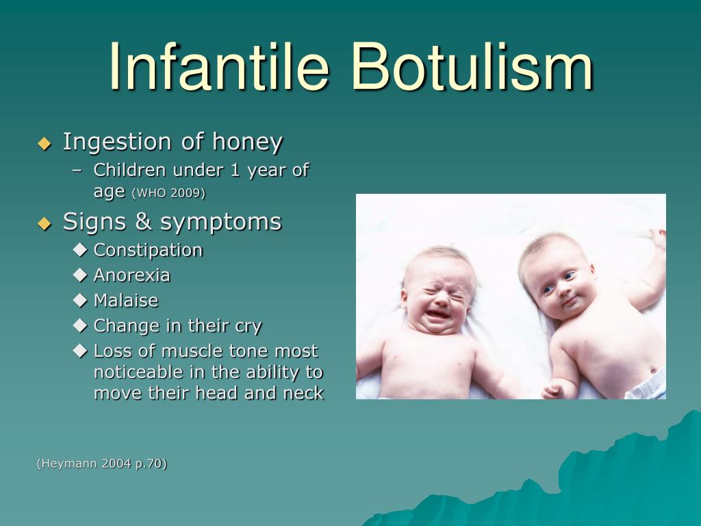 PPT Botulism In The Alaska Bush PowerPoint Presentation, free