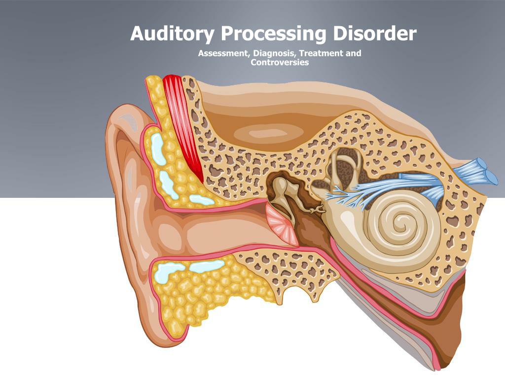 PPT Auditory Processing Disorder PowerPoint Presentation, free