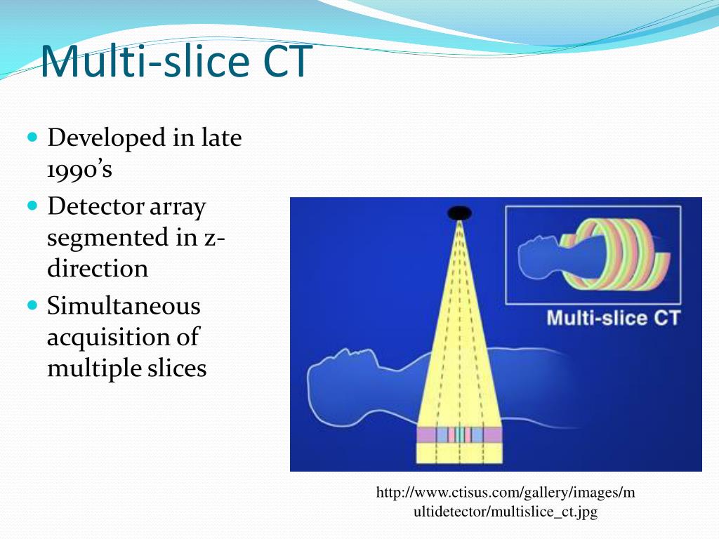 PPT MultiSlice CT PowerPoint Presentation, free download ID5573730