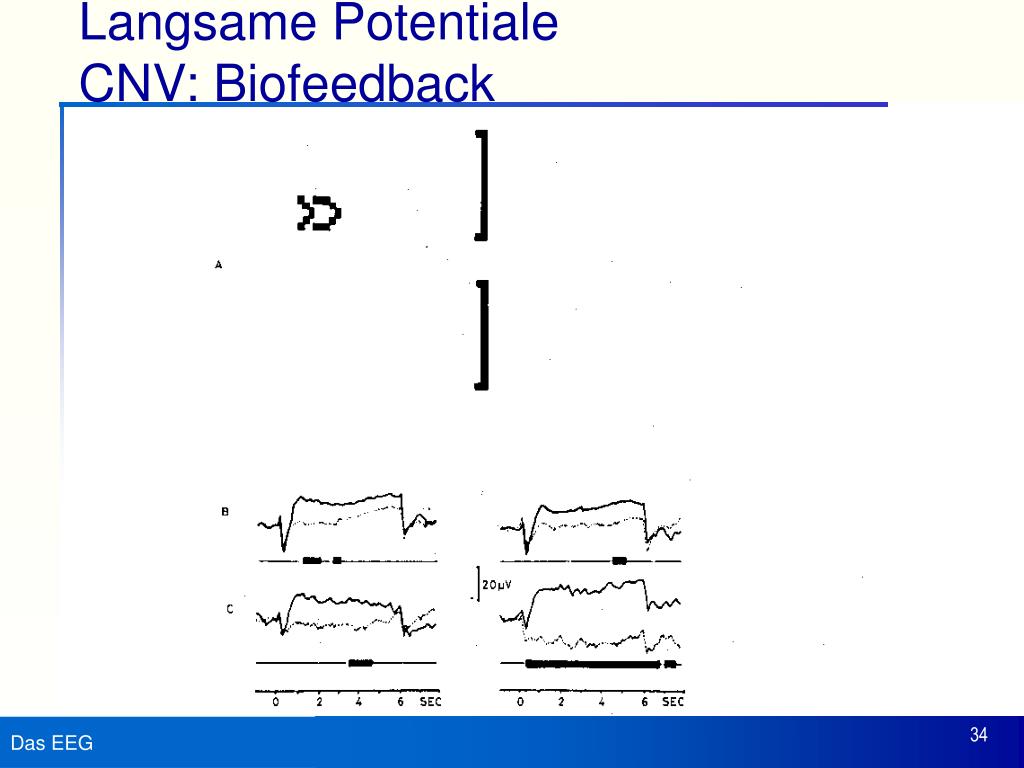 PPT Methoden der biologischen Psychologie PowerPoint