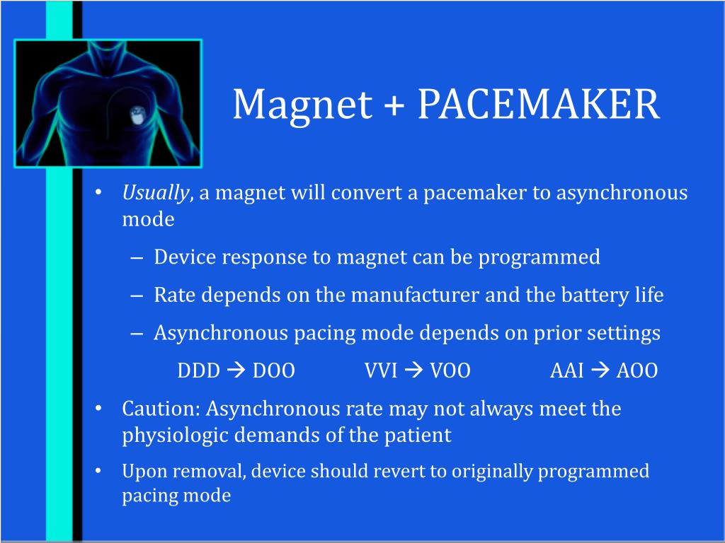 PPT “Just Put a On It” An Update on Cardiac Implantable