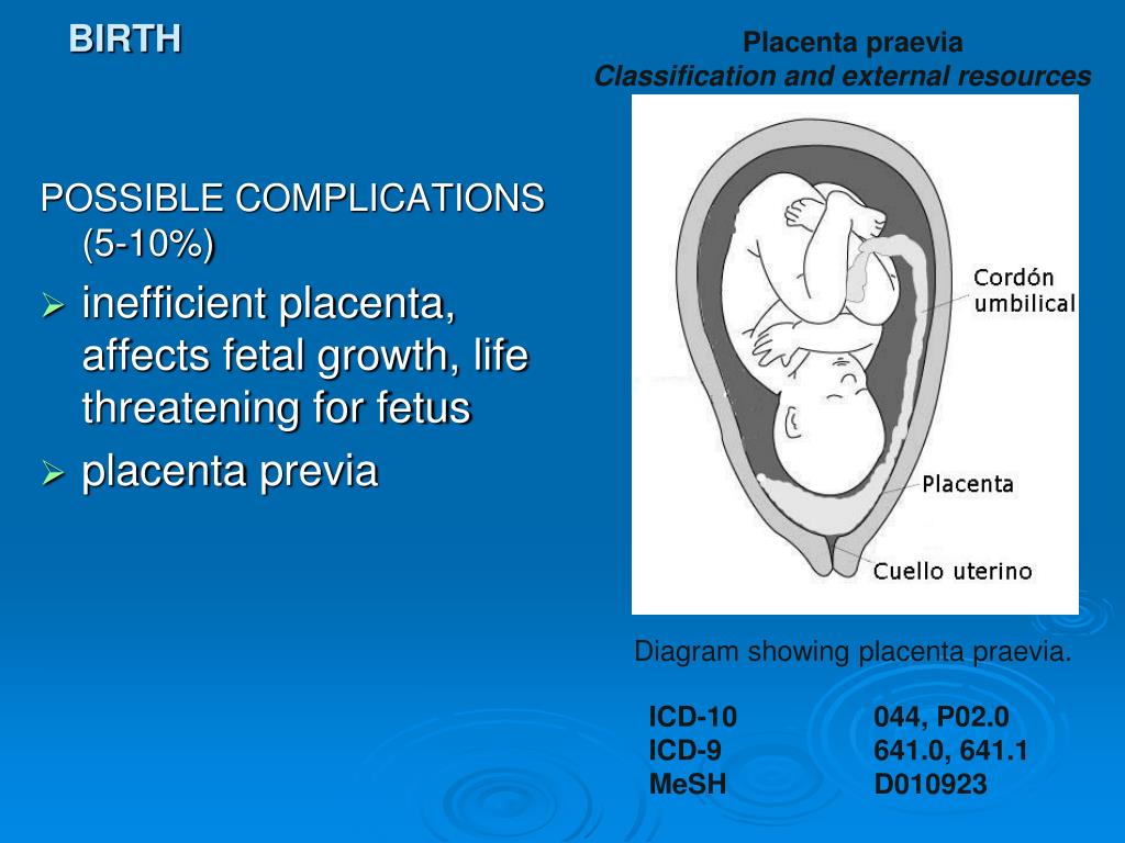 PPT Birth PowerPoint Presentation ID5620984