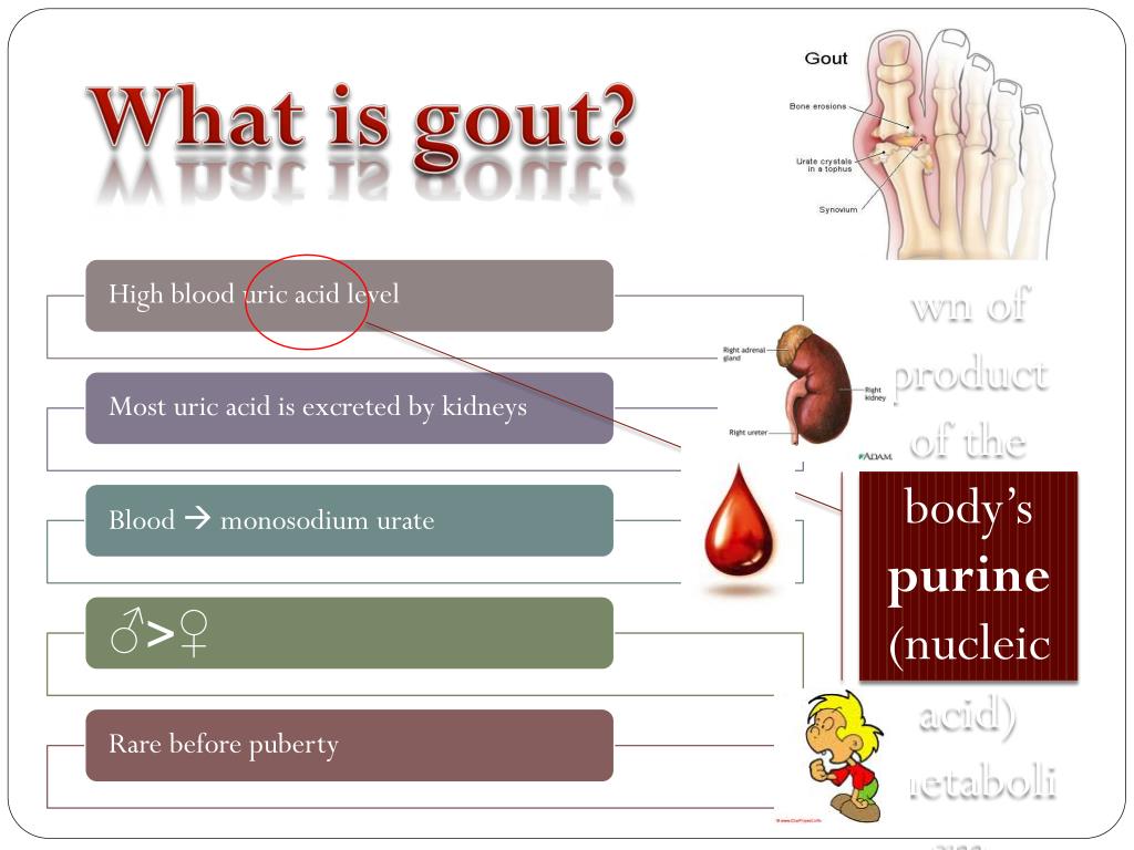 PPT GOUT PowerPoint Presentation, free download ID5636237