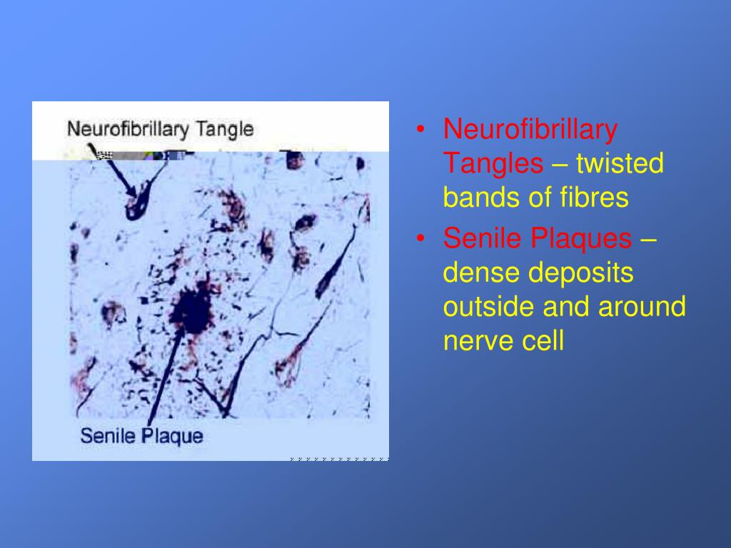 PPT Advanced Dementia and Nutrition PowerPoint Presentation, free