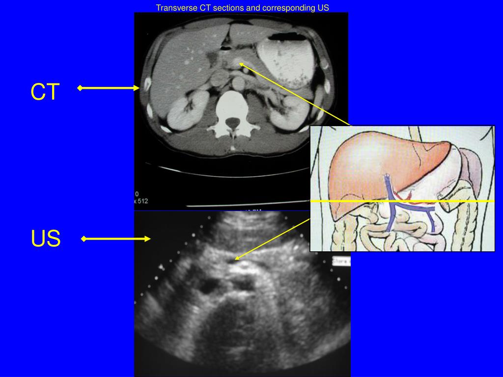 PPT M2 HEPATOBILIARY IMAGING PowerPoint Presentation, free download