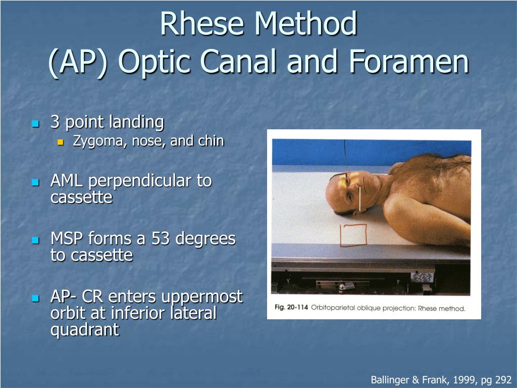 PPT Radiography of the Orbits PowerPoint Presentation, free download