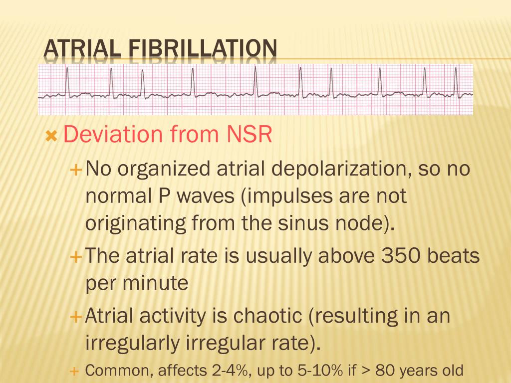 PPT ELECTROCARDIOGRAM (ECG) PowerPoint Presentation ID5673130