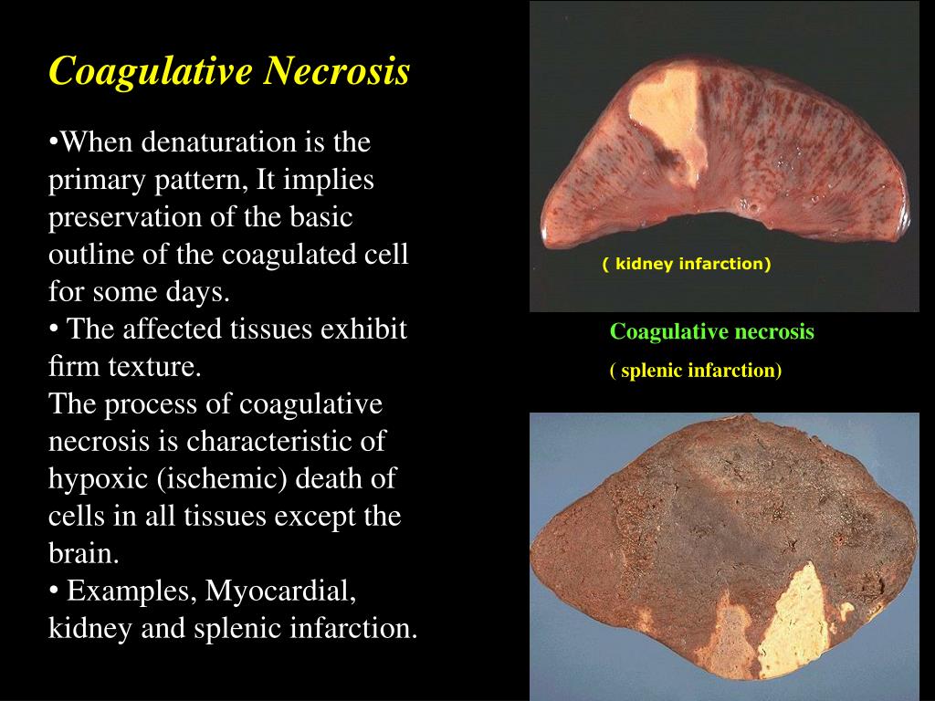 PPT Lesson one Cell Injury PowerPoint Presentation, free download