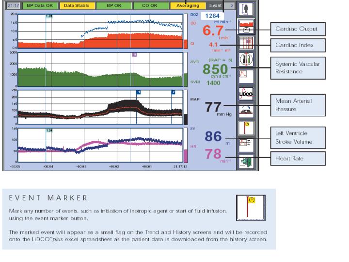 PPT Hemodynamic Monitoring PowerPoint Presentation ID5715167