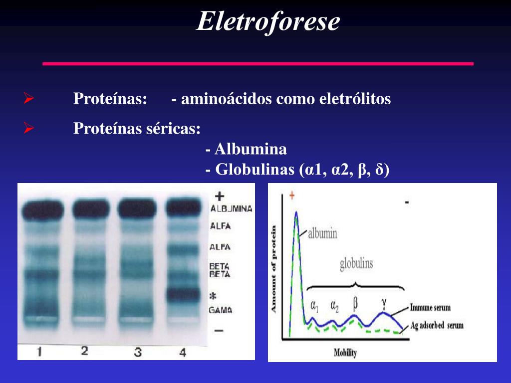 PPT Eletroforese PowerPoint Presentation, free download ID5716692