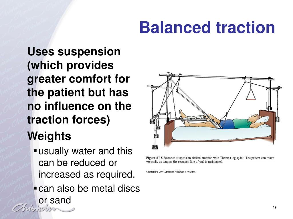 PPT Musculoskeletal Disorders PowerPoint Presentation, free download