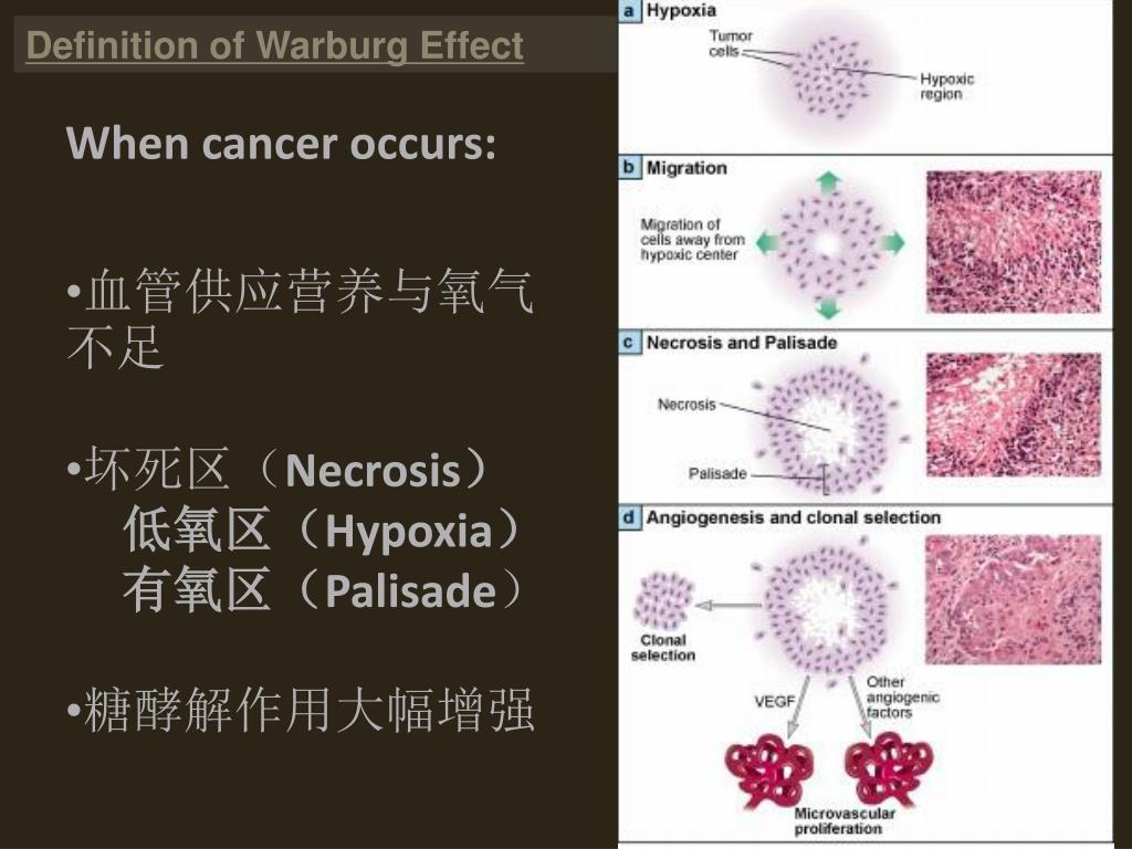 PPT WARBURG EFFECT PowerPoint Presentation, free download ID5749654