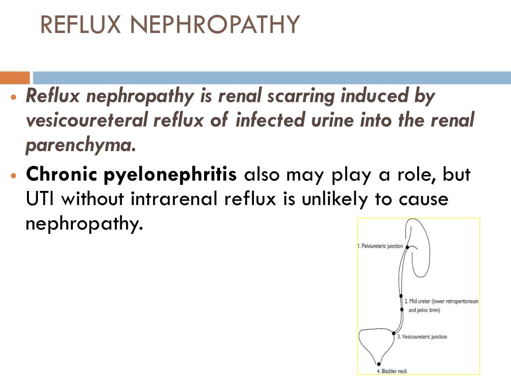 PPT Tubulointerstitial Disease PowerPoint Presentation, free download