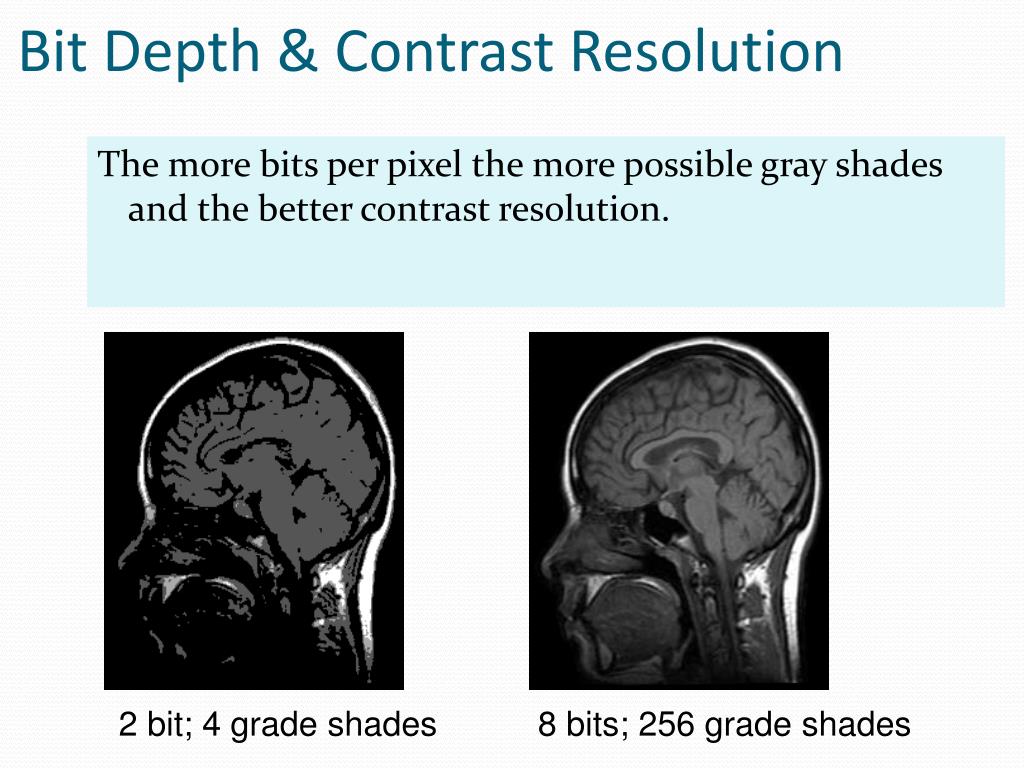 PPT Fundamentals of Digital Radiology PowerPoint Presentation, free download ID5760072