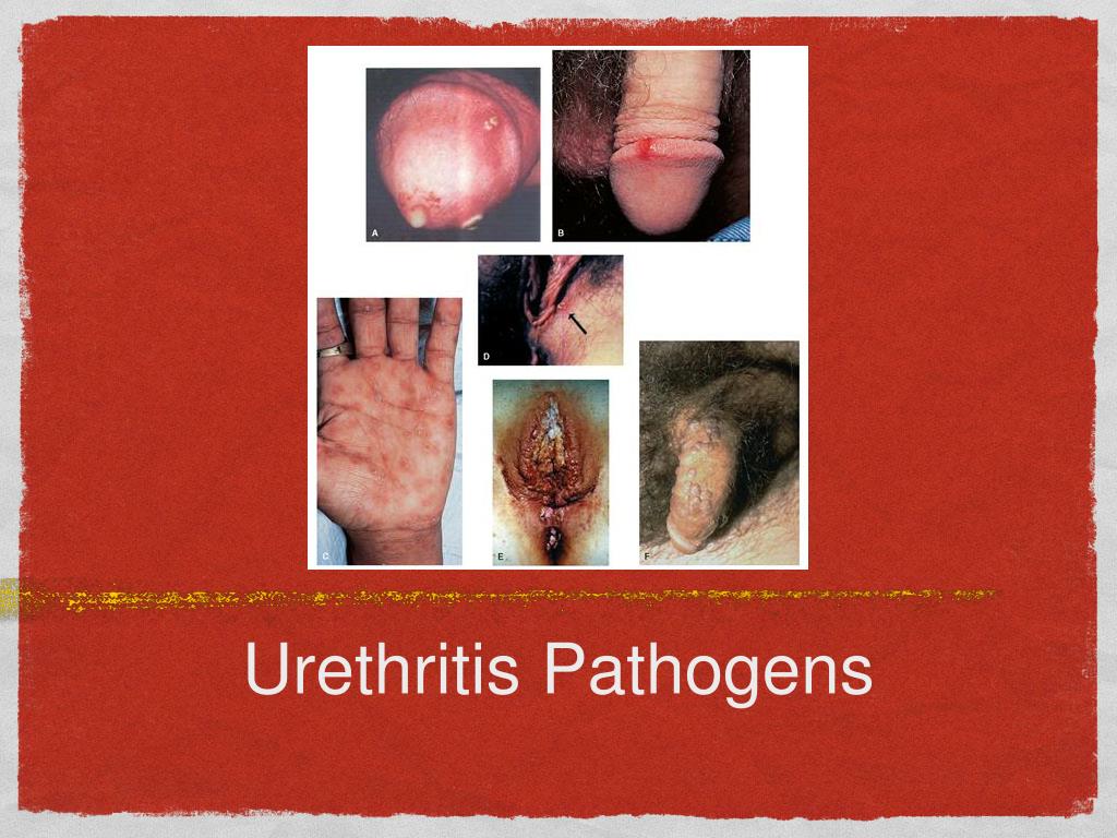 PPT Pediatric Resident Academic Half Day PowerPoint Presentation