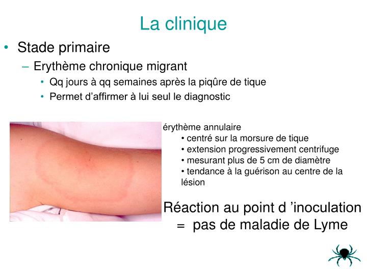 3 questions à une malade de Lyme chronique Pensées sauvages