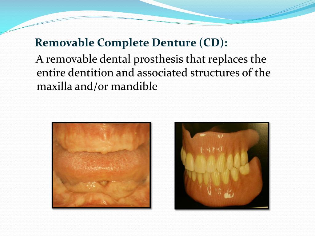 PPT Introduction to Removable Prosthodontics PowerPoint Presentation
