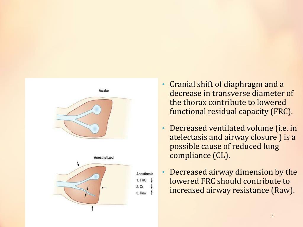 PPT RESPIRATORY PHYSIOLOGY DURING ANESTHESIA PowerPoint Presentation