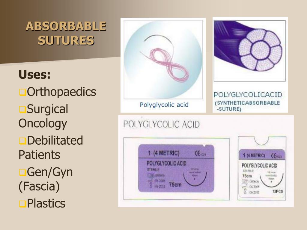 PPT Sutures PowerPoint Presentation, free download ID5880654