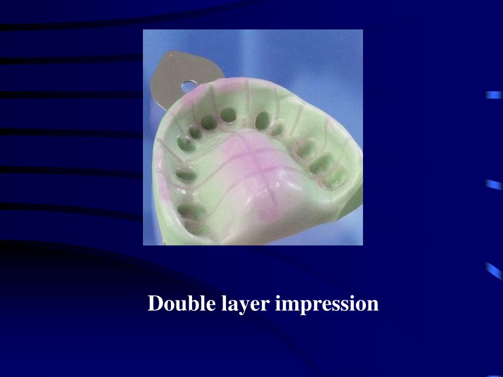 PPT Types of impressions Previous Final PowerPoint Presentation, free download ID5944514