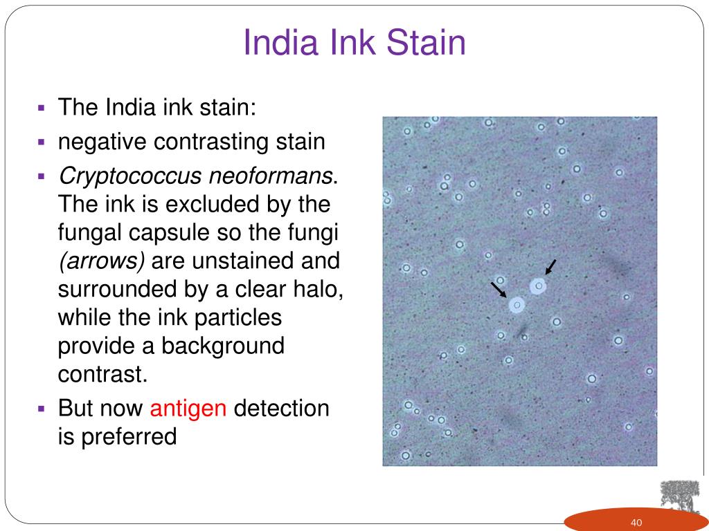 PPT Laboratory Diagnosis of Infectious Diseases PowerPoint