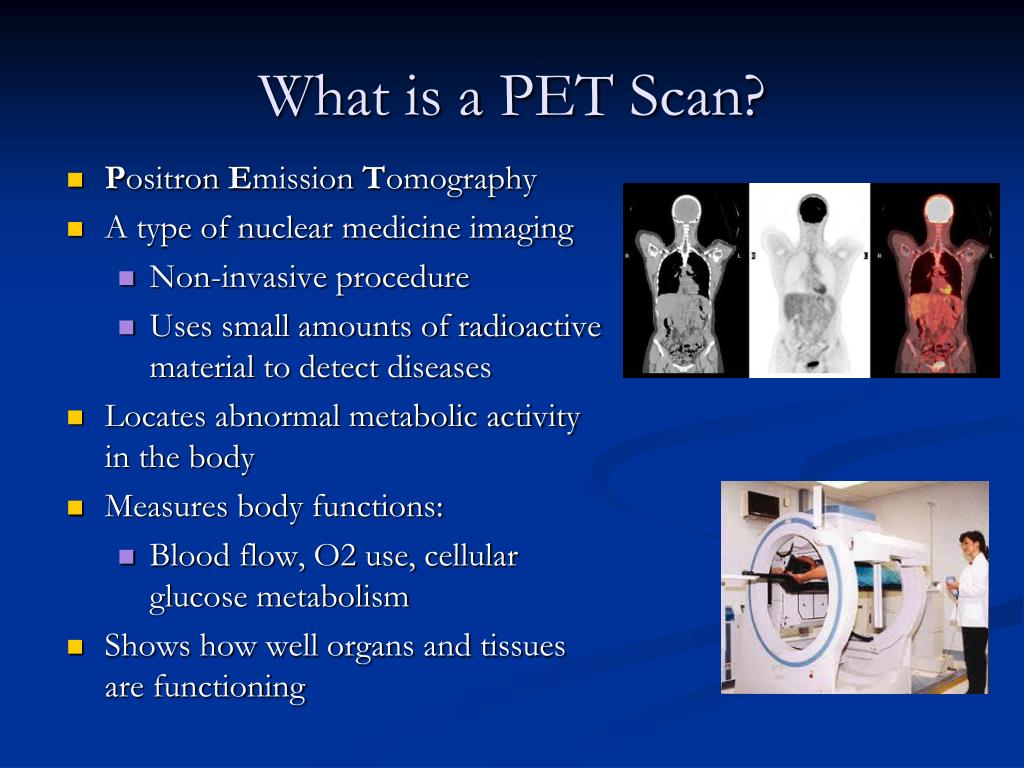 PPT Ultrasound PowerPoint Presentation, free download ID5961545