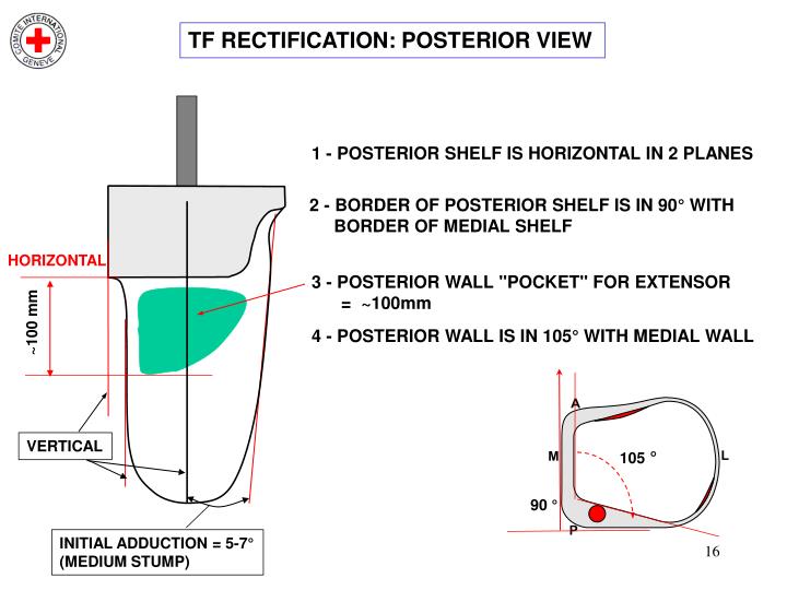 PPT MEASUREMENTS, CASTING & RECTIFICATION FOR TRANSFEMORAL (TF