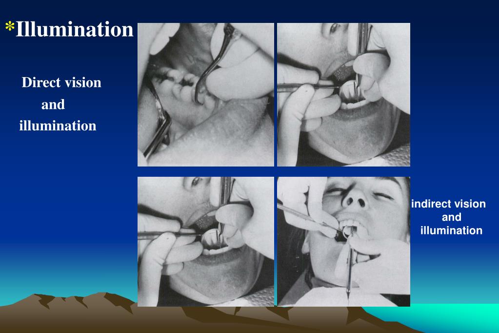 PPT Periodontal Instrumentation (II) PowerPoint Presentation, free