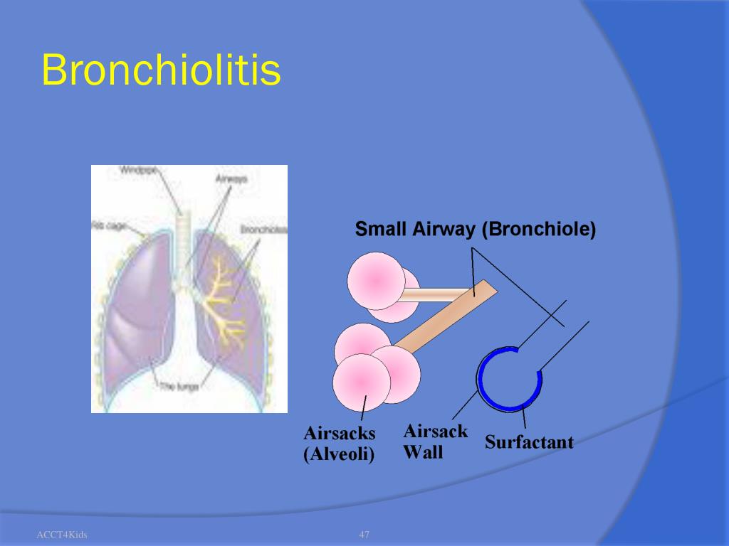 PPT Recognition and Initial Management of Pediatric Shock and