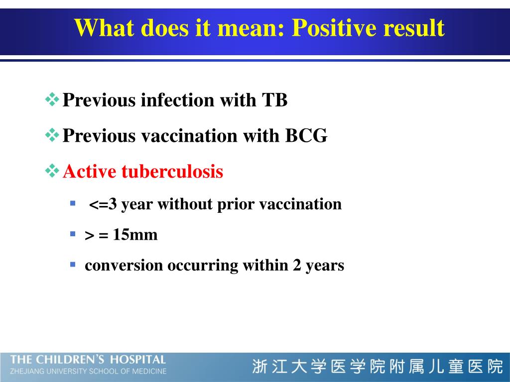 PPT Tuberculosis in children PowerPoint Presentation