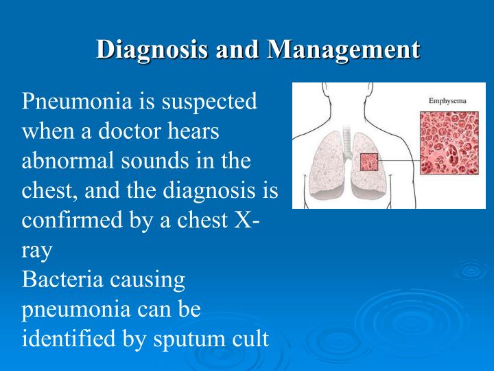 PPT Pneumonia PowerPoint Presentation ID6032537