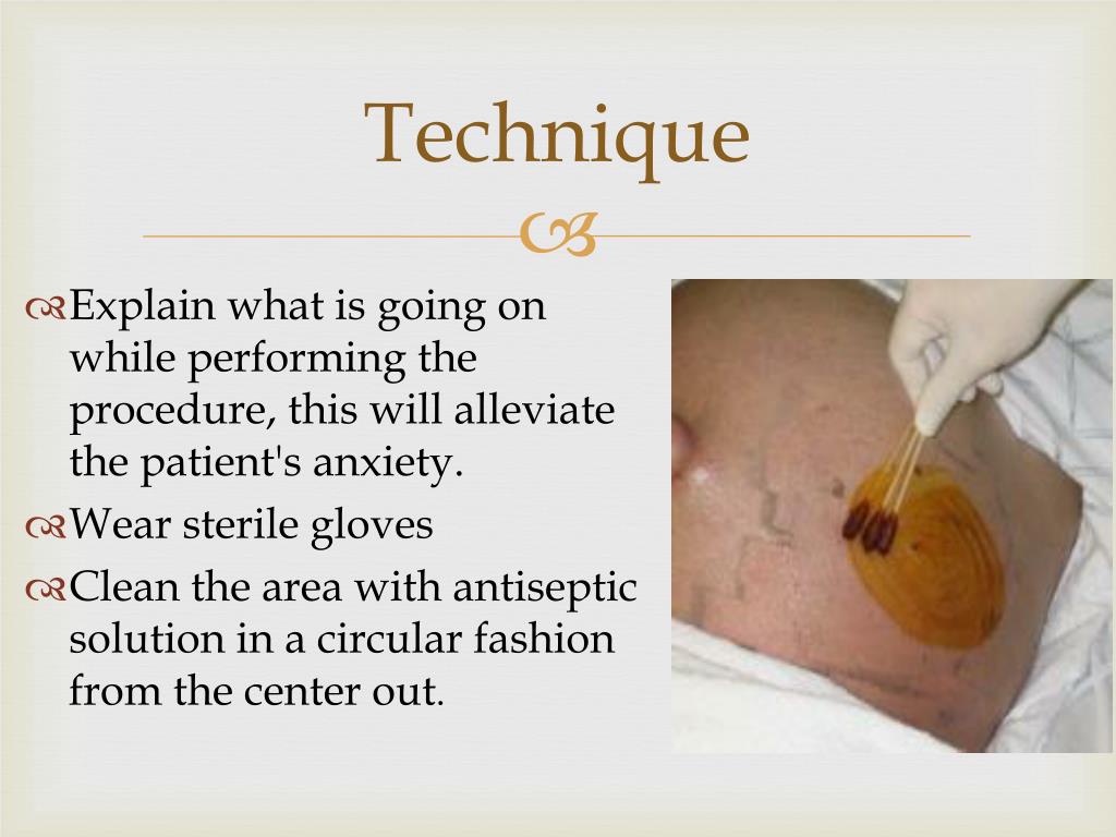 PPT Abdominal paracentesis PowerPoint Presentation, free download