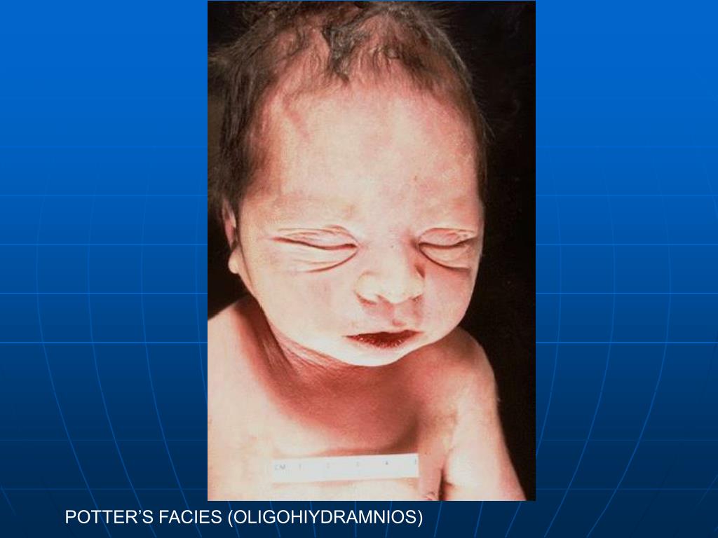 PPT DISEASES OF INFANCY & CHILDHOOD I PowerPoint Presentation ID