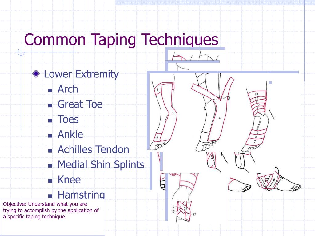 PPT Bandaging and Taping Techniques PowerPoint Presentation, free