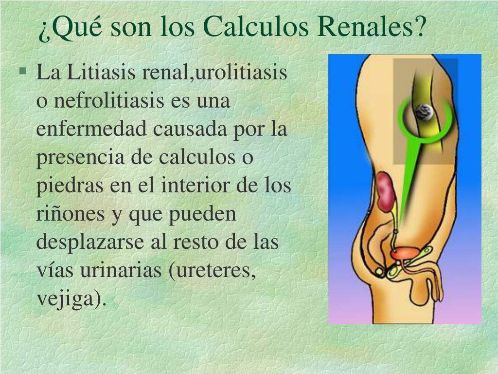 PPT UROLITIASIS RENAL PowerPoint Presentation ID6063690