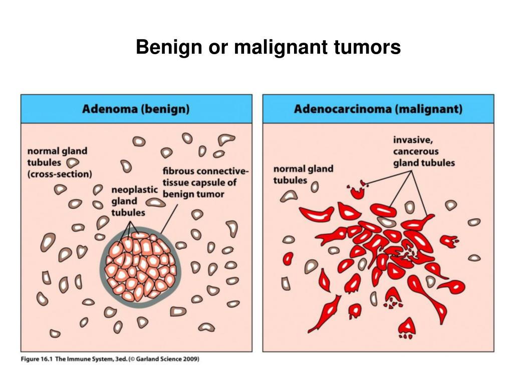 PPT TUMOR IMMUNOLOGY PowerPoint Presentation, free download ID6068643