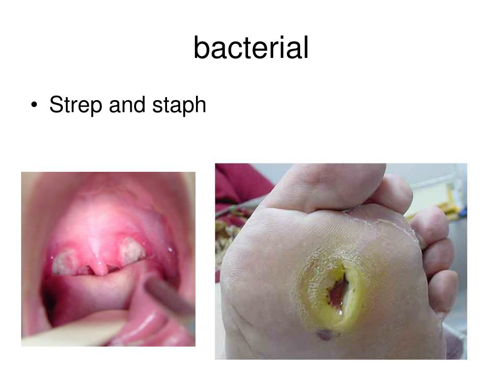 PPT The immune System PowerPoint Presentation, free download ID6074859